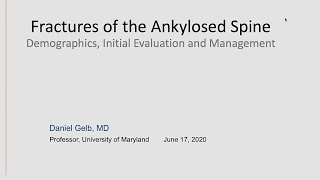 Fractures of the Ankylosed Spine [upl. by Walther]