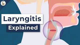 Why Do You Lose Your Voice  Laryngitis Explained [upl. by Cleaves]