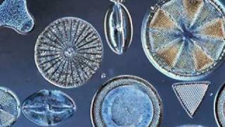 Beautiful Diatoms [upl. by Amre]