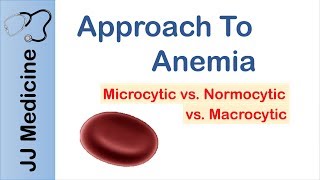 Anemia  Microcytic vs Normocytic vs Macrocytic [upl. by Aserej]