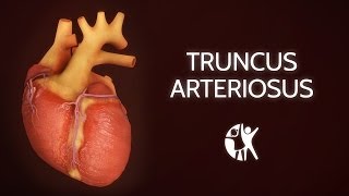 Pulmonary Hypertension Animation [upl. by Westberg]