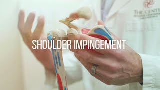 Shoulder Impingement Causes and Treatment [upl. by Savvas295]