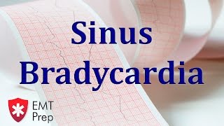 Sinus Bradycardia ECG  EMTprepcom [upl. by Cattier]