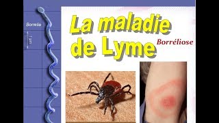 Maladie lyme Symptômes Diagnostic Traitement [upl. by Fuchs]