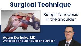 Biceps Tenodesis in the Shoulder Surgical Technique [upl. by Kartis]