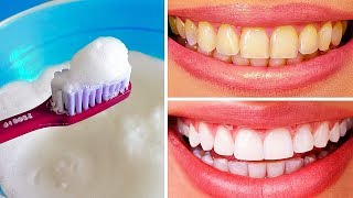 10 Natural Ways to Whiten Teeth at Home [upl. by Gambrell860]