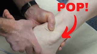 Peroneus longus subluxation How to treat it [upl. by Deidre]