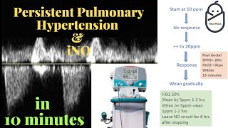 ECHOCARDIOGRAPHIC ASSESSMENT OF PULMONARY ARTERIAL HYPERTENSION IN THE NEWBORN [upl. by Rennie]