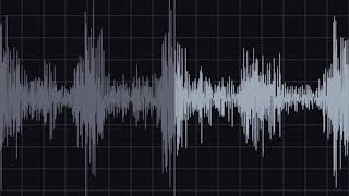 AV Fistula Recording amp Waveform  Eko Health [upl. by Shalom]