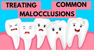 Management of Common Malocclusions Orthodontics [upl. by Prasad649]