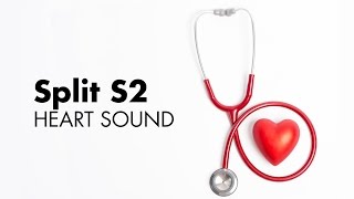 Fixed Split S2  Heart Sounds  MEDZCOOL [upl. by Weissmann]