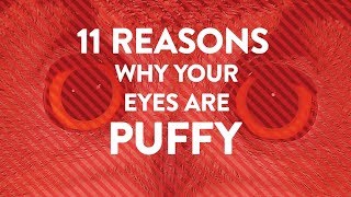 11 Reasons Why Your Eyes Are Puffy  Health [upl. by Settle]