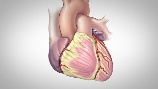 Milia  Stringoma Removal  Periorbital Area [upl. by Morette]