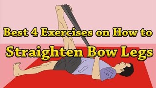 Best 4 Exercises on How to Straighten Bow Legs [upl. by Ingalls693]