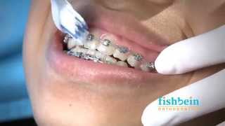 Orthodontic Home Care Instructions  Braces  Brushing [upl. by Eyot]