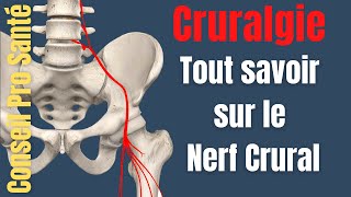 Cruralgie  Quest ce que le nerf crural  nerf fémoral [upl. by Cozza]