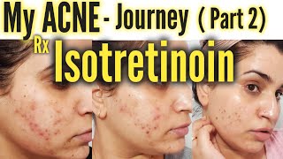 My Acne Journey Part 2  Isotretinoin [upl. by Whitcher472]