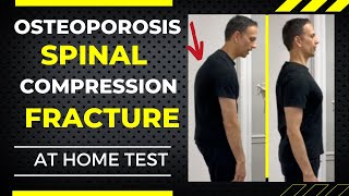 Spinal Compression Fracture From Osteoporosis Is it too LATE [upl. by Berky]