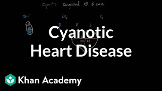 What is cyanotic heart disease  Circulatory System and Disease  NCLEXRN  Khan Academy [upl. by Enitsirc309]