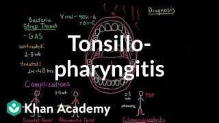 Pharyngitis  Respiratory system diseases  NCLEXRN  Khan Academy [upl. by Carrick]