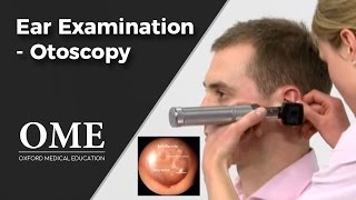 Otoscopy Ear Examination  ENT [upl. by Jilleen]