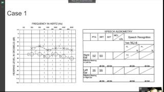 speech audiometry practice [upl. by Wonacott]