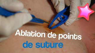 Ablation de points de suture [upl. by Chainey]