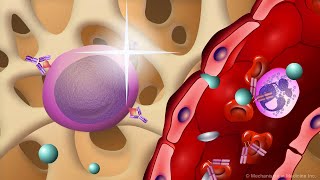 Emerging Waldenström Macroglobulinemia Treatment Approaches [upl. by Maude299]