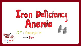 IRON DEFICIENCY ANEMIA Causes Clinical Features Pathophysiology Diagnosis Treatment  Rhesus [upl. by Sexton]