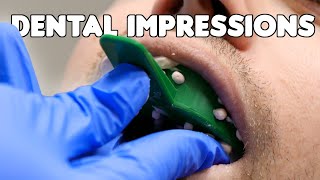 Dental Impressions amp Pouring Teeth Models [upl. by Nedyrb]