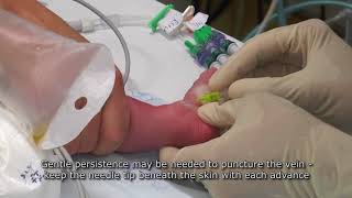 Paediatric Anaesthetics Chapter 7  Long saphenous IV neonate 1 [upl. by Yderf]