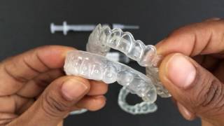 How to use Tooth Whitening Trays [upl. by Roumell]