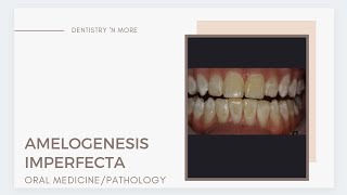 AMELOGENESIS IMPERFECTA [upl. by Nikolai812]