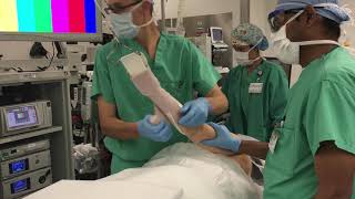 Basic Shoulder Arthroscopy Lateral Decubitus Patient Positioning [upl. by Baalbeer442]