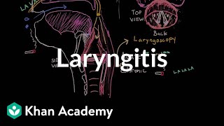 What is laryngitis   Respiratory system diseases  NCLEXRN  Khan Academy [upl. by Nafis]