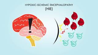 What are the symptoms of CTE [upl. by Chessy]