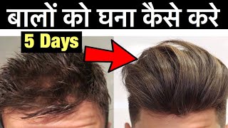 बालों को घना कैसे करे  Natural Way to Stop Hair Fall  Regrow Hair Fast How to Get Thicker Hair [upl. by Muldon408]