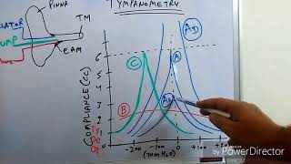 Tympanometry Impedance Audiometry [upl. by Ecurb]