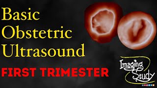 Basic Obstetric Ultrasound First Trimester Pregnancy [upl. by Llennahs]