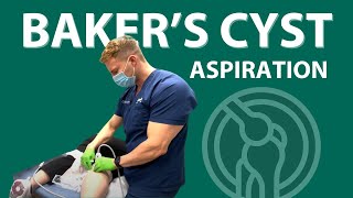 Bakers Cyst Treatment [upl. by Chrissie]