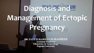 RCOG Guidelines Diagnosis and Managment of Ectopic Pregnancy [upl. by Bertram168]