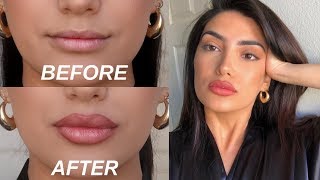 HOW TO FAKE BIG LIPS IN 3 EASY STEPS OMG [upl. by Brightman]