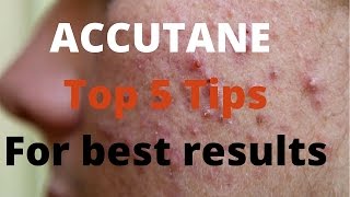 Accutane 5 tips by Dermatologists [upl. by Hara]