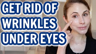 How to GET RID OF UNDER EYE WRINKLES Dr Dray [upl. by Connelly]