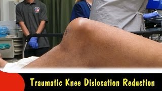 Traumatic Knee Dislocation ReductionQuick Version [upl. by Michell]