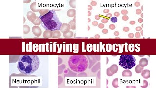 Identifying Leukocytes [upl. by Marigold]