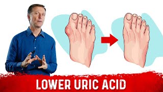 4 Ways to Neutralize Uric Acid [upl. by Portingale745]