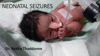 Neonatal Seizures  Pediatrics [upl. by Hungarian]