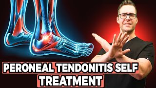 Peroneal Tendonitis Self Treatment Stretches Exercises amp Massage [upl. by Adnaral509]