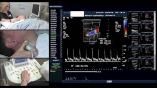 Cardiovascular and Vascular Interventional Radiology Coding [upl. by Annovad]